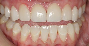 Family, Cosmetic & Implant Dentist in Lexington, KY