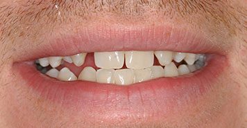 Family, Cosmetic & Implant Dentist in Lexington, KY