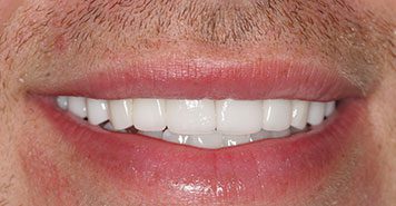 Family, Cosmetic & Implant Dentist in Lexington, KY
