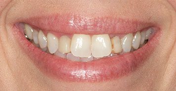 Family, Cosmetic & Implant Dentist in Lexington, KY