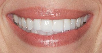 Family, Cosmetic & Implant Dentist in Lexington, KY