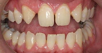 Family, Cosmetic & Implant Dentist in Lexington, KY