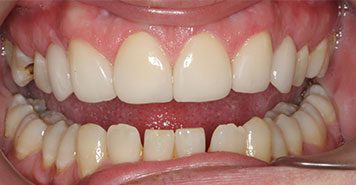 Family, Cosmetic & Implant Dentist in Lexington, KY