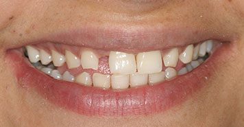 Family, Cosmetic & Implant Dentist in Lexington, KY