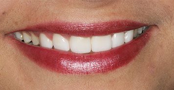 Family, Cosmetic & Implant Dentist in Lexington, KY