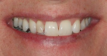Family, Cosmetic & Implant Dentist in Lexington, KY