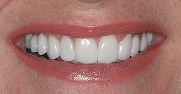 Family, Cosmetic & Implant Dentist in Lexington, KY