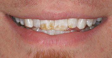 Family, Cosmetic & Implant Dentist in Lexington, KY