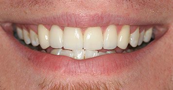 Family, Cosmetic & Implant Dentist in Lexington, KY