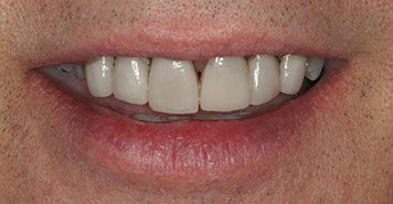 Family, Cosmetic & Implant Dentist in Lexington, KY