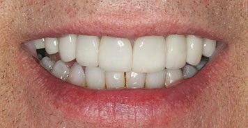 Family, Cosmetic & Implant Dentist in Lexington, KY