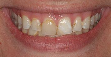 Family, Cosmetic & Implant Dentist in Lexington, KY