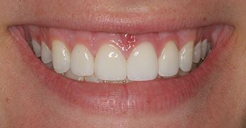 Family, Cosmetic & Implant Dentist in Lexington, KY