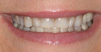 Family, Cosmetic & Implant Dentist in Lexington, KY