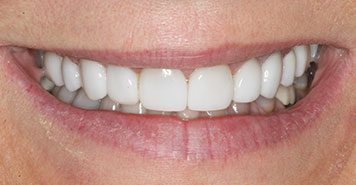 Family, Cosmetic & Implant Dentist in Lexington, KY