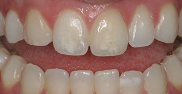 Family, Cosmetic & Implant Dentist in Lexington, KY