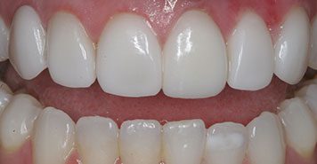 Family, Cosmetic & Implant Dentist in Lexington, KY