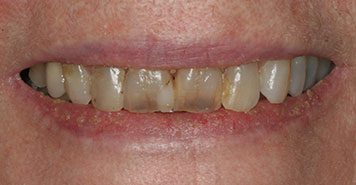Family, Cosmetic & Implant Dentist in Lexington, KY