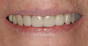 Family, Cosmetic & Implant Dentist in Lexington, KY