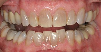Family, Cosmetic & Implant Dentist in Lexington, KY