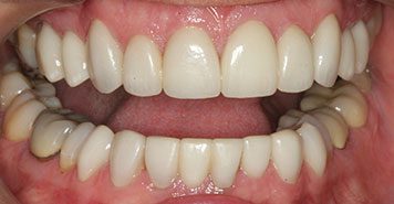 Family, Cosmetic & Implant Dentist in Lexington, KY