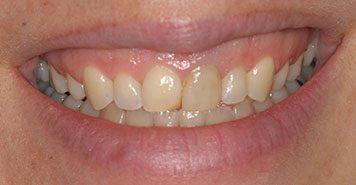 Family, Cosmetic & Implant Dentist in Lexington, KY