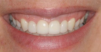 Family, Cosmetic & Implant Dentist in Lexington, KY