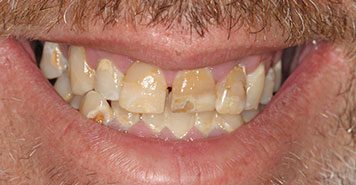 Family, Cosmetic & Implant Dentist in Lexington, KY