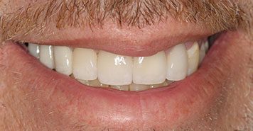 Family, Cosmetic & Implant Dentist in Lexington, KY