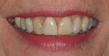 Family, Cosmetic & Implant Dentist in Lexington, KY