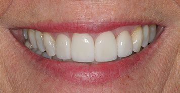 Family, Cosmetic & Implant Dentist in Lexington, KY