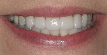 Family, Cosmetic & Implant Dentist in Lexington, KY