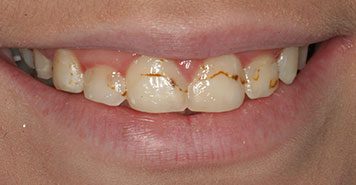 Family, Cosmetic & Implant Dentist in Lexington, KY