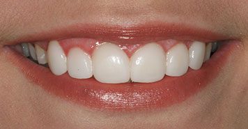 Family, Cosmetic & Implant Dentist in Lexington, KY