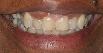 Family, Cosmetic & Implant Dentist in Lexington, KY