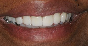 Family, Cosmetic & Implant Dentist in Lexington, KY