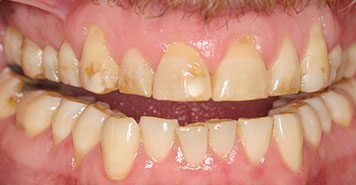 Family, Cosmetic & Implant Dentist in Lexington, KY