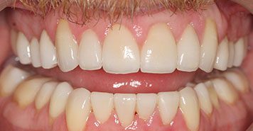 Family, Cosmetic & Implant Dentist in Lexington, KY