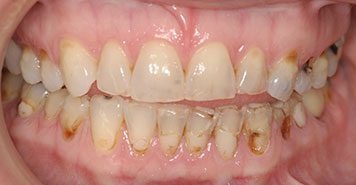 Family, Cosmetic & Implant Dentist in Lexington, KY
