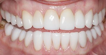 Family, Cosmetic & Implant Dentist in Lexington, KY
