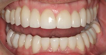 Family, Cosmetic & Implant Dentist in Lexington, KY