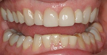 Family, Cosmetic & Implant Dentist in Lexington, KY