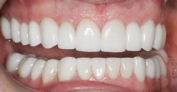Family, Cosmetic & Implant Dentist in Lexington, KY