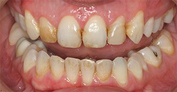Family, Cosmetic & Implant Dentist in Lexington, KY
