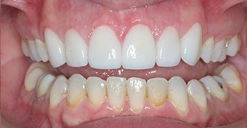 Family, Cosmetic & Implant Dentist in Lexington, KY