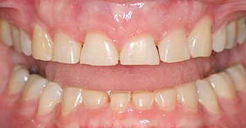 Family, Cosmetic & Implant Dentist in Lexington, KY