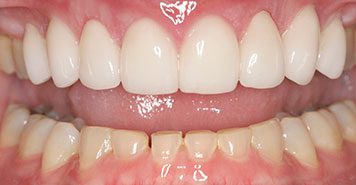 Family, Cosmetic & Implant Dentist in Lexington, KY