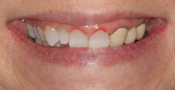 Family, Cosmetic & Implant Dentist in Lexington, KY