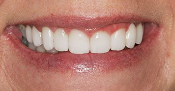 Family, Cosmetic & Implant Dentist in Lexington, KY