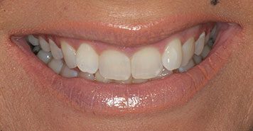 Family, Cosmetic & Implant Dentist in Lexington, KY